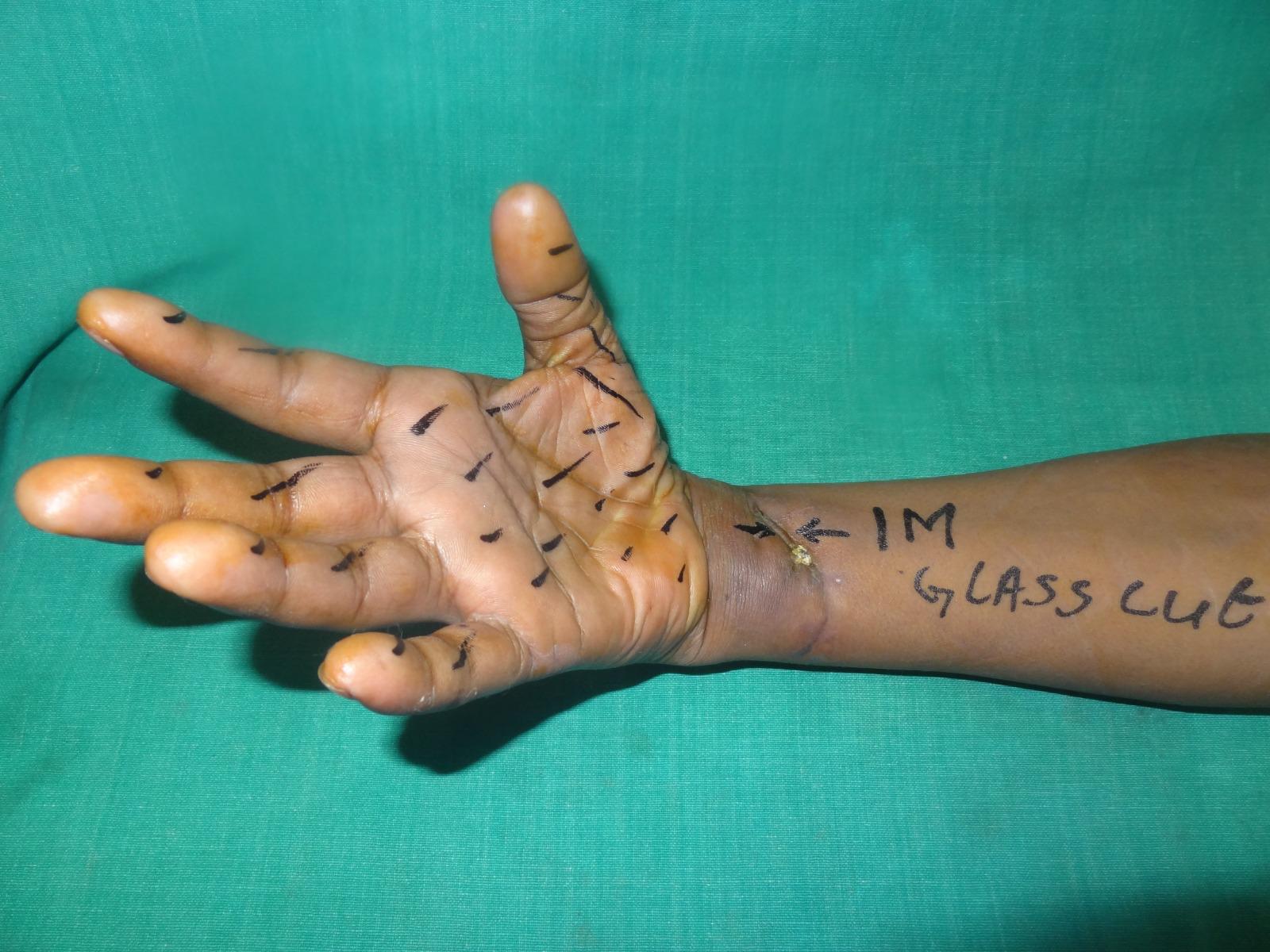 Case 1 Operation Image